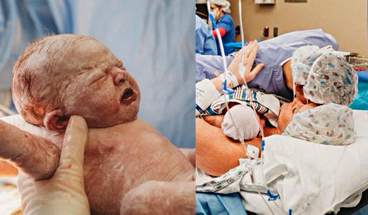 Mămica ajută la nașterea prin cezariană: scoate bebeșul cu mâinile ei